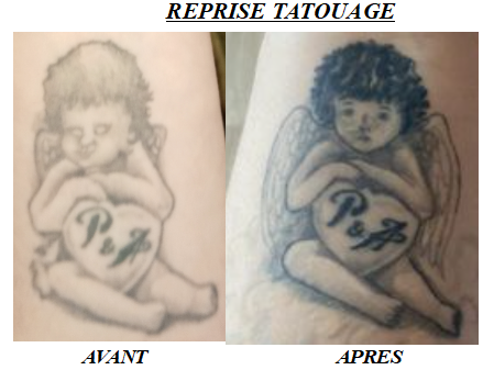 Reprise